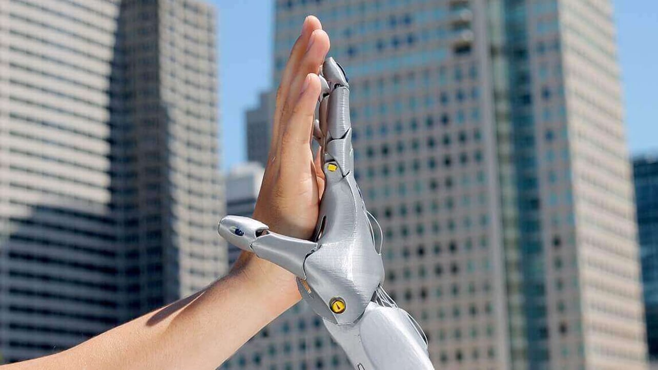 3D Printed Prosthetics