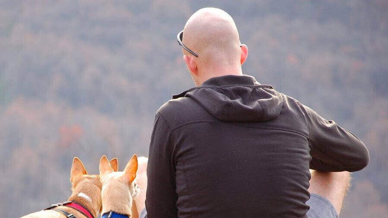 L Oreal Wants To Cure Baldness With 3d Printed Hair Follicles All3dp