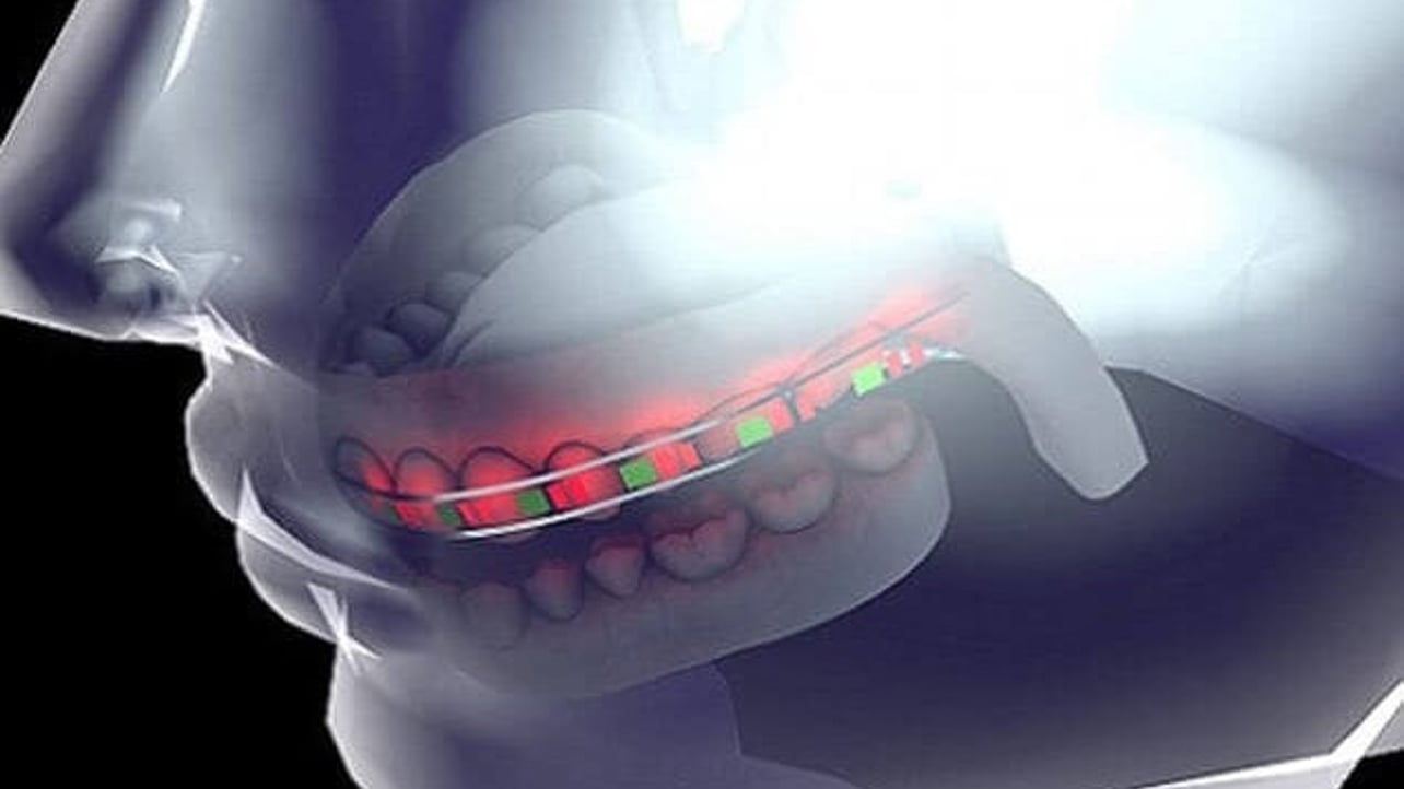 3d Printed Braces With Led Lights And Micro Batteries Save Time
