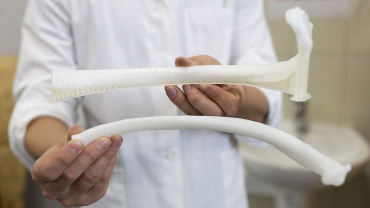 Bulgarian Doctors Implant First 3d Printed Rib All3dp