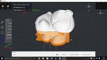Image of Best 3D Printer Slicer Software / 3D Slicer: ideaMaker