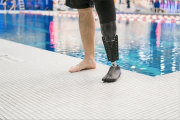 3d Printed Prosthetic Leg 5 Most Promising Projects All3dp