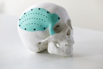 Medical 3D Printing: The Best Healthcare Applications | All3DP Pro