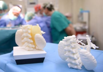 Obraz studium przypadku: Medyczny druk 3D: modele 3D skracają czas operacji