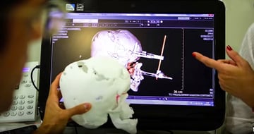 Obraz studium przypadku: Medyczny druk 3D: wysokie zapotrzebowanie na szpitalny druk 3D