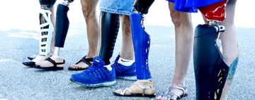 Unyq is a company that looks to make prosthetics personal and normalized