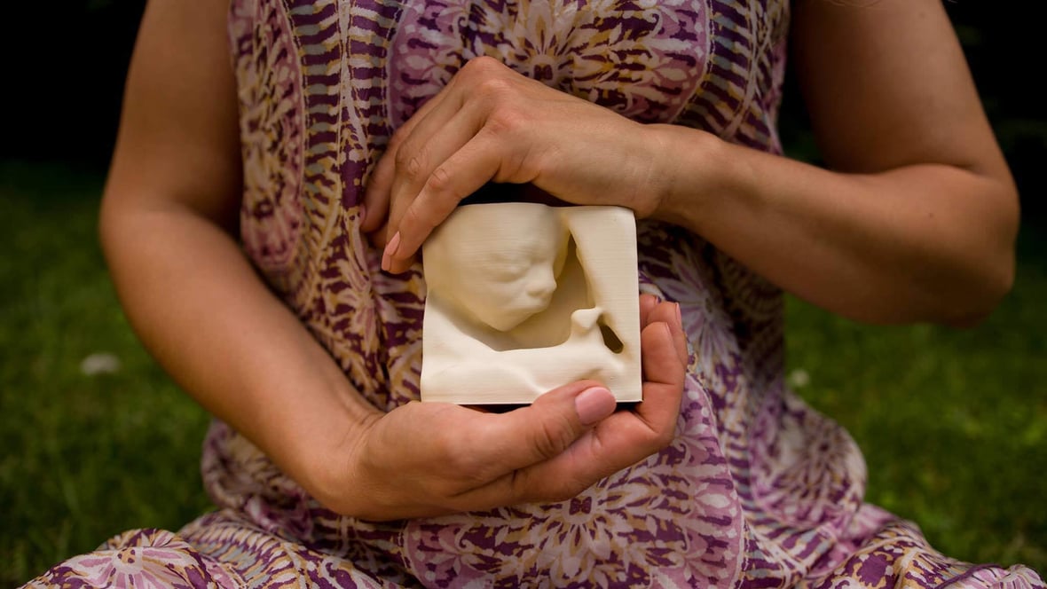 Featured image of Blind Mothers “See” Unborn Babies with In Utero 3D