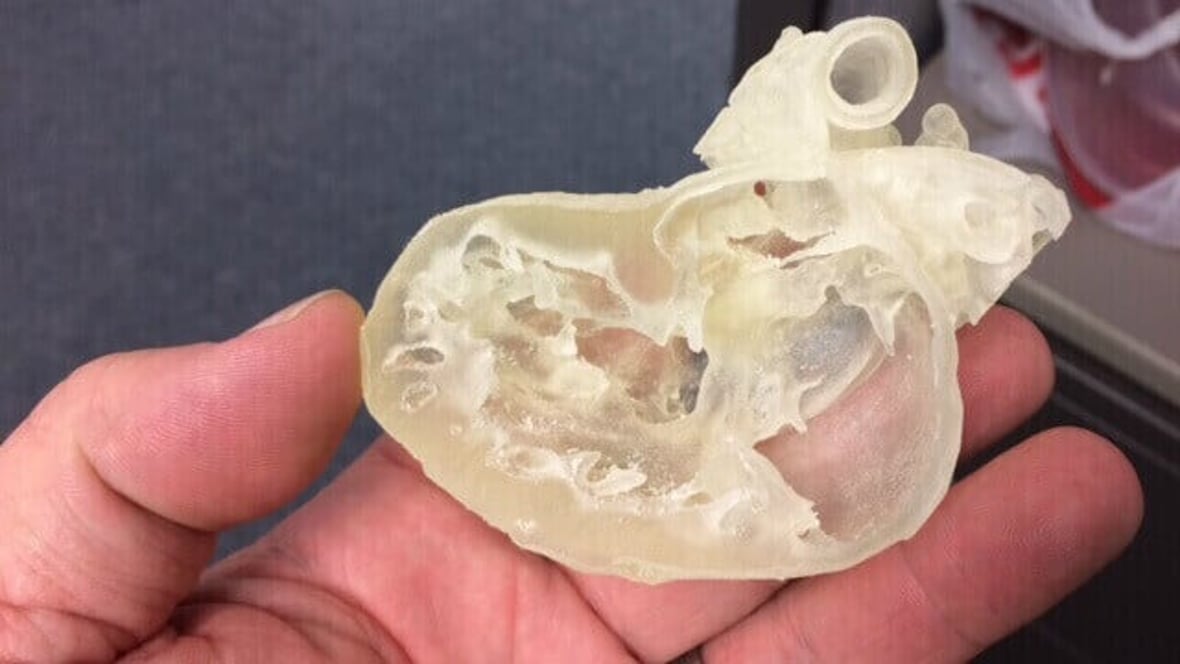 Featured image of Stratasys 3D Printers to Support Nonprofit OpHeart Clinical Study on Pediatric Heart Surgery