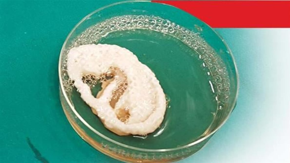 Featured image of Scientists in India are Growing Ears in the Lab using Cartilage and a 3D Printed Scaffold