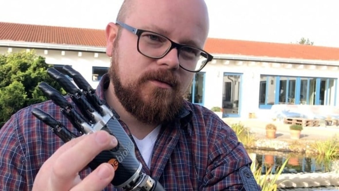 This Man's 3D Printed Bionic Arm is Thought-Controlled | All3DP