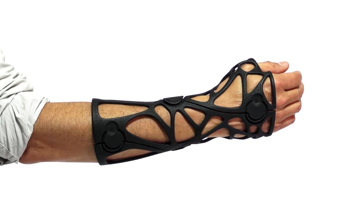Featured image of 3D Printed Orthotics: Most Promising Projects in 2023
