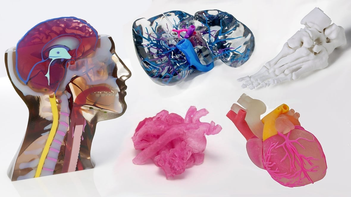 Featured image of 3D Printed Medical Models – State of the Art