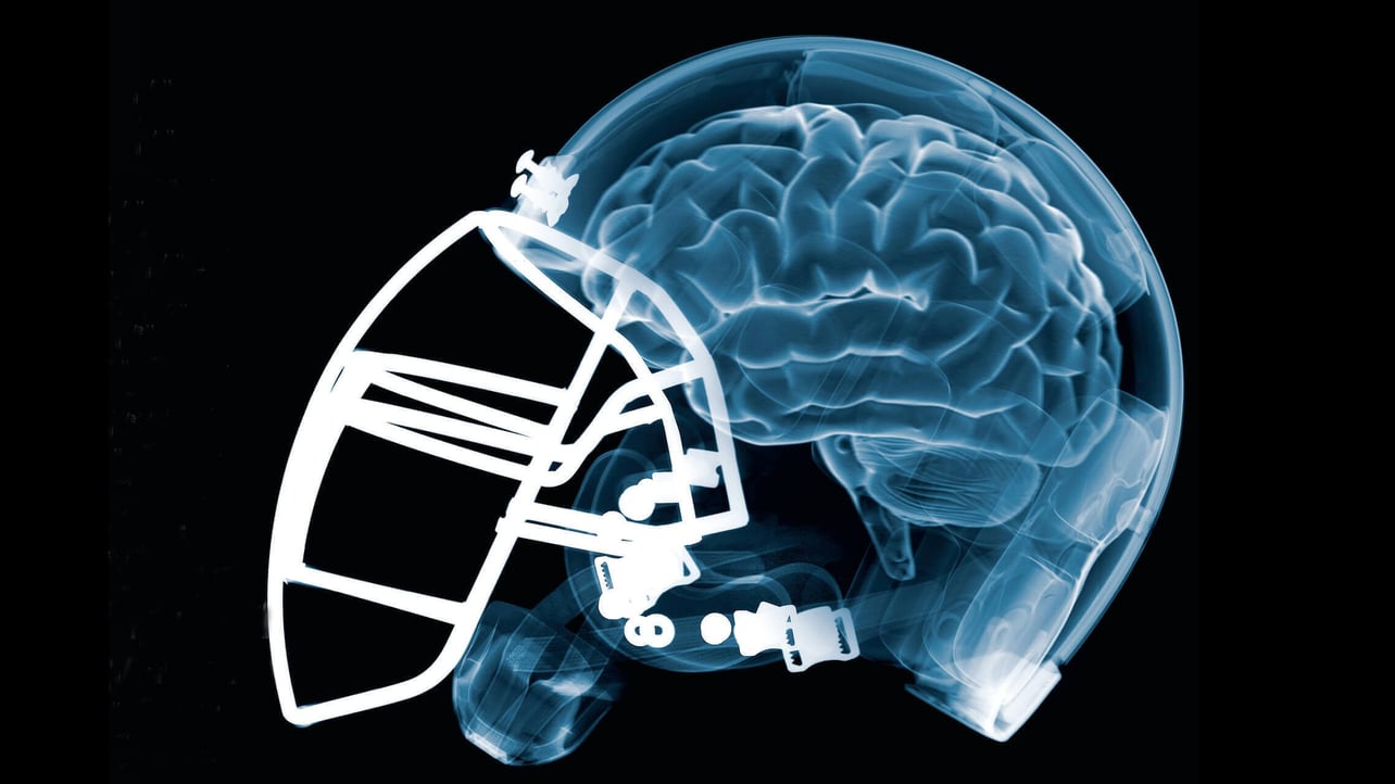 Featured image of NFL backs 3D Printed Helmet Material to Reduce Brain Injuries