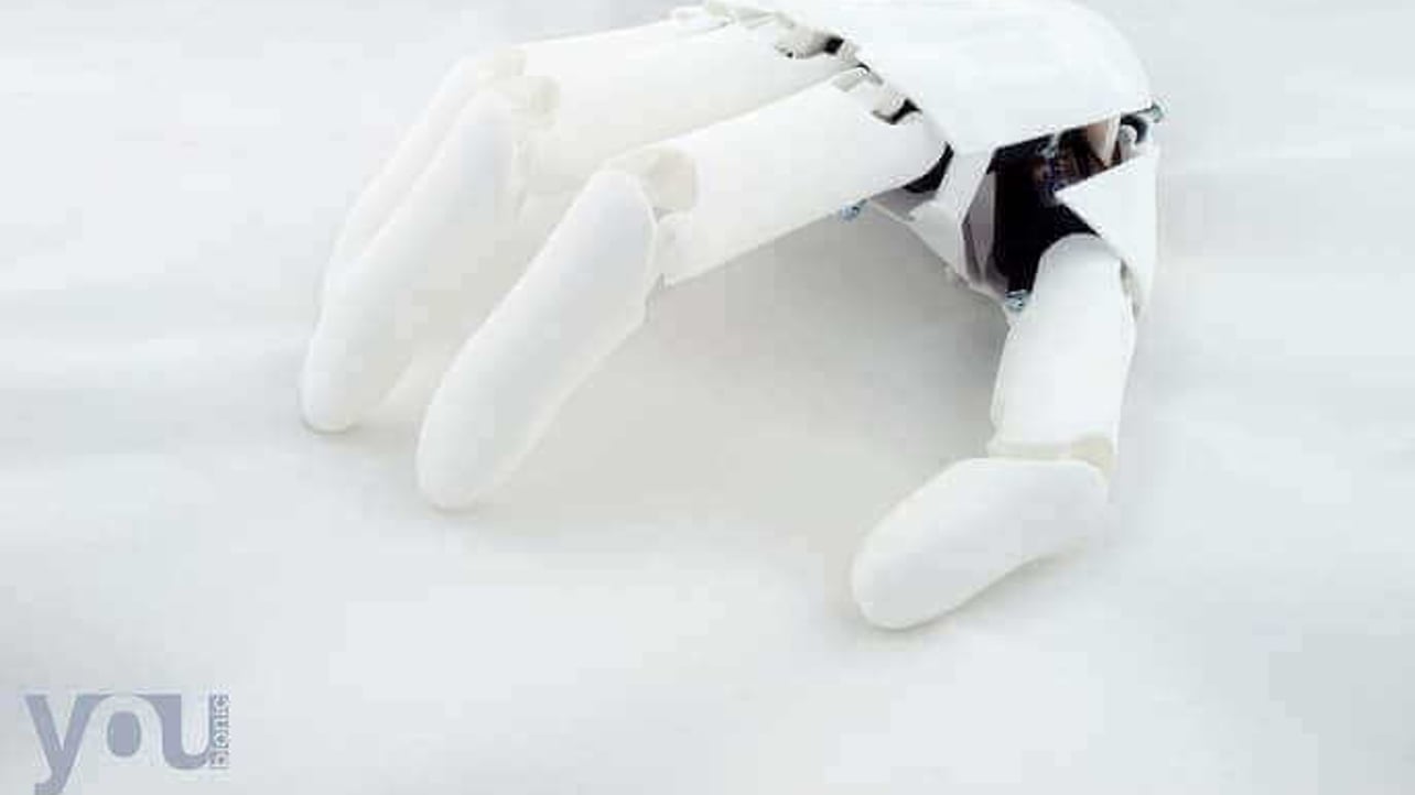 Featured image of New Youbionic Prosthetic Costs Only €1,200