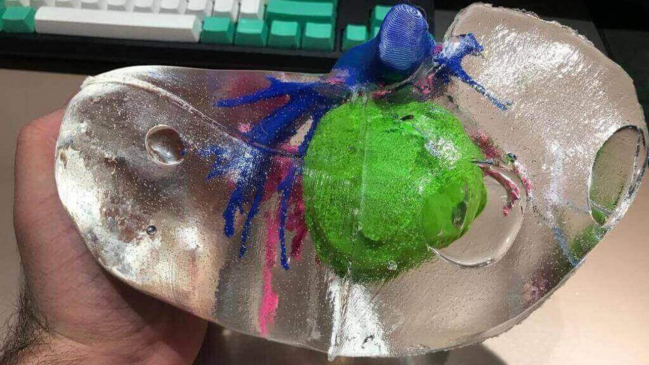 Featured image of Multicolored 3D Printed Livers Help Doctors Prepare for Tumor Surgery