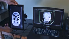 Featured image of Explore Your MRI Data With a Tablet, Vive Tracker, and a 3D Printed Adapter