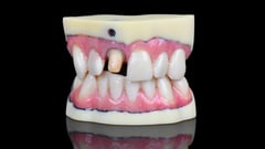 Featured image of Stratasys Unveils High Resolution J720 Dental 3D Printer