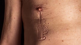 Featured image of “Hey Pressto” Project Turns Skin Into Stop Motion Animation With 3D Printed Stamps