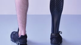 Featured image of 3D Printed Prosthetic Leg: 5 Most Promising Projects