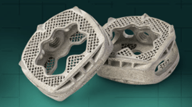Featured image of Additive Implants’ 3D Printed SureMAX Cervical Spacer Cleared by FDA