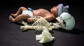 Featured image of 3D Printed Newborn Baby Manikin Improves Resuscitation Training