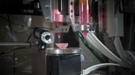 Featured image of 3D Printed Kidney: The Latest Advancements