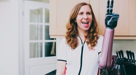 Featured image of The Most Common 3D Printed Prosthetics of 2023