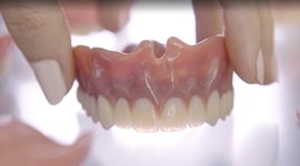 Featured image of Ready-to-Wear Dentures from the 3D Printer