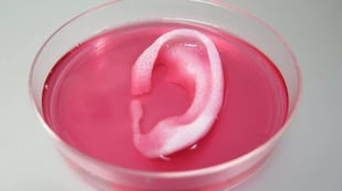 Featured image of Australian Toddler to have World’s First 3D Printed Ear