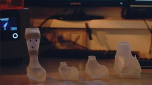 Featured image of Father 3D Prints Orthoses for his Son, Now Helps Others