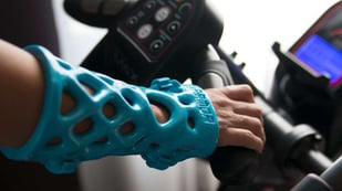 Featured image of 3D Printed Cast: The Most Promising Projects