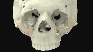 Featured image of 3D Printed Bones: The Most Jaw-Dropping Projects
