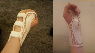 Featured image of How to 3D Print a Lightweight Wrist Brace