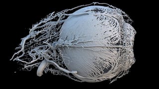 Featured image of 3D Printed Pig’s-Eye Model Shortlisted for Wellcome Image Awards 2017