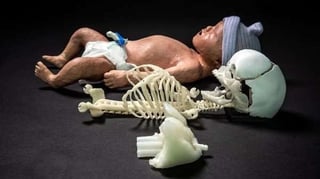 Featured image of 3D Printed Newborn Baby Manikin Improves Resuscitation Training