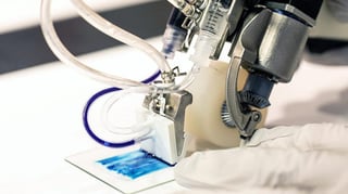 Featured image of Handheld Skin 3D Printer Can Help Burn Victims