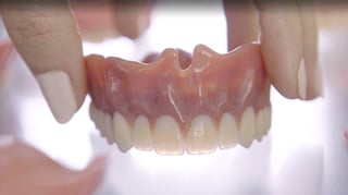 Featured image of Ready-to-Wear Dentures from the 3D Printer
