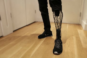 3D printed prosthetic limbs improves countless lives