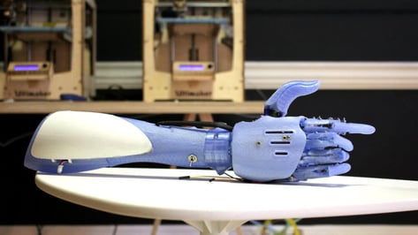 Featured image of Reddit begins crowdsourcing next generation bionics
