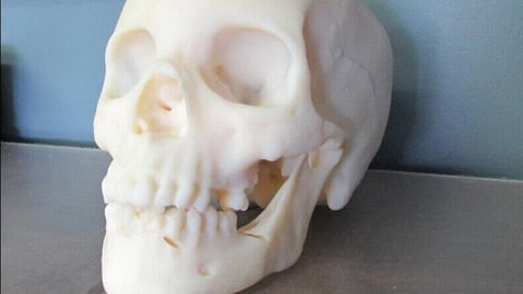 Featured image of 3D Printing Used to Reproduce a Murder Victim’s Skull in a Cold Case