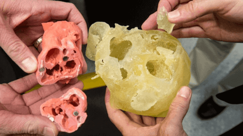 Featured image of Caterpillar Collaborates With Surgeons to Print Heart Models