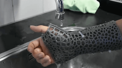 Featured image of 3D Printed Orthopedic Casts Offer Custom Thermal-Comfort Design