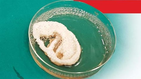 Featured image of Scientists in India are Growing Ears in the Lab using Cartilage and a 3D Printed Scaffold