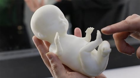 Featured image of 3D Printed Ultrasound: Get a 3D Printed Model of your Unborn Child!