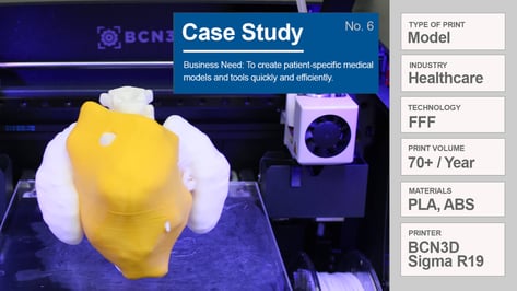 Featured image of Case Study: Why Hospitals Need 3D Printers