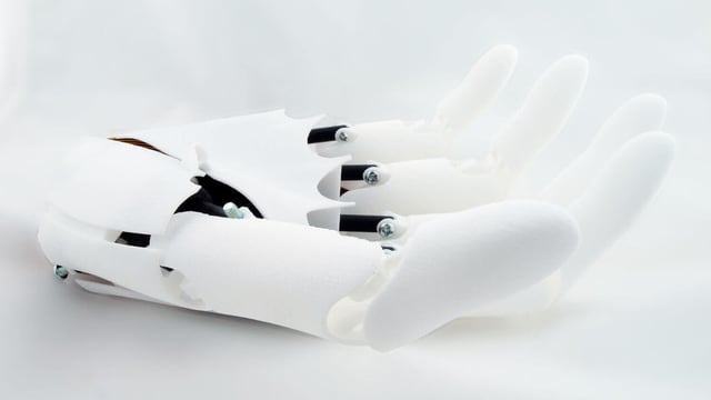 Featured image of 3D Printed Prosthetics made with Laser Sintering