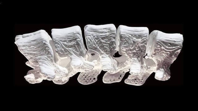 Featured image of 3D Printed Hyperelastic Bone Could Heal Fractures in Weeks