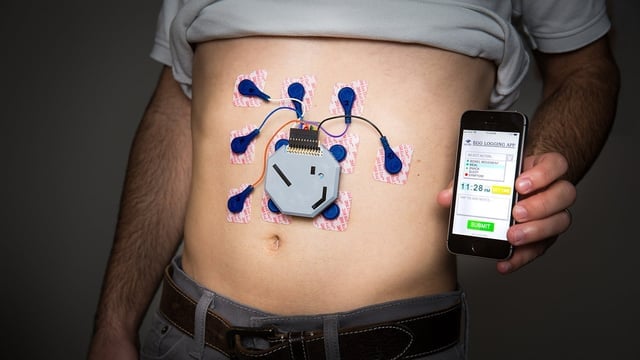 Featured image of This 3D Printed Wearable Can Monitor Stomach Activity
