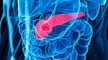 Imagen principal de Bioprinting an Artificial Pancreas for Type 1 Diabetes