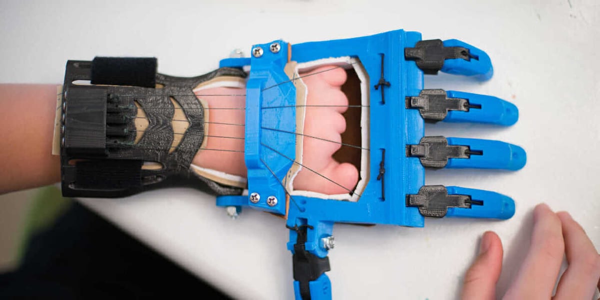 An advanced prosthetic hand.